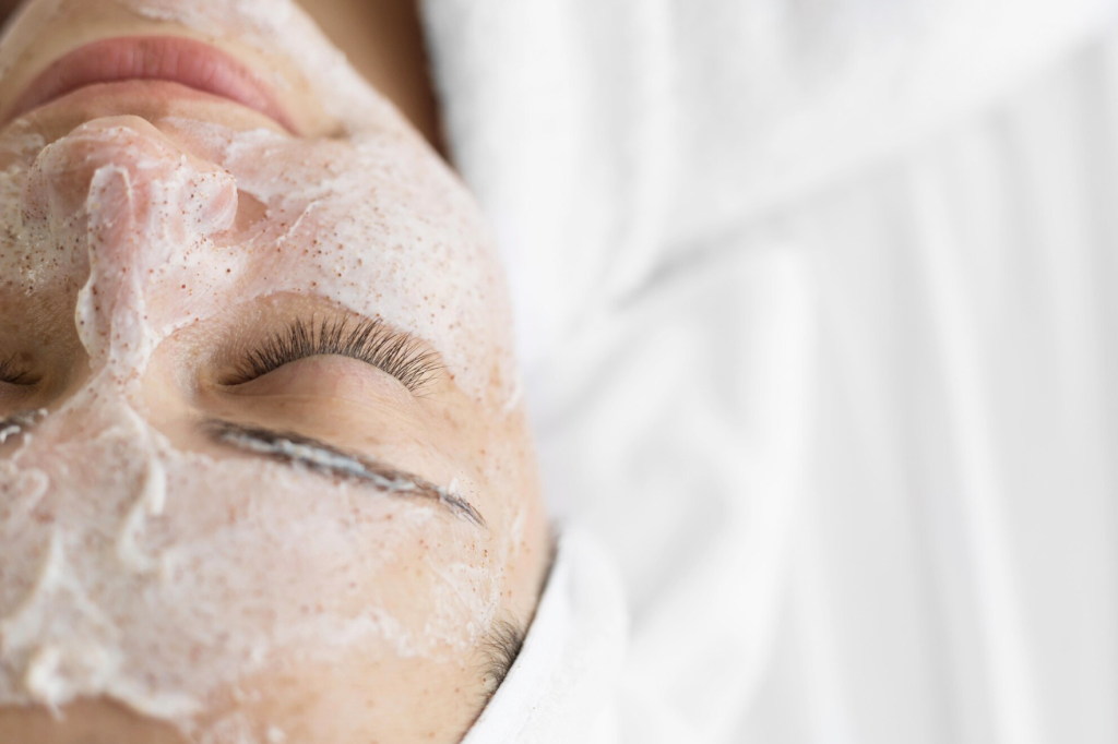 Peeling químico